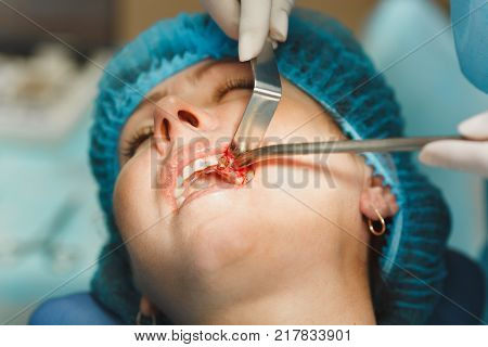 Male Old Professional Dentist Surgeon In Uniform And Female Assistant Helps To Performing Operation