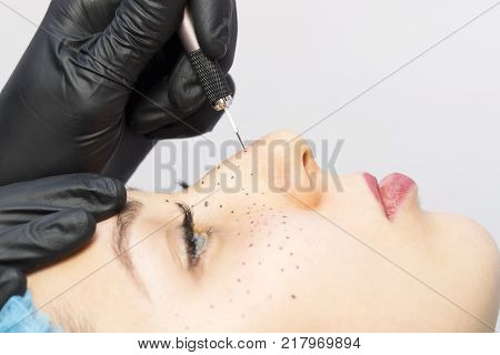 Permanent microblasting tattooing freckles to a woman in a beauty salon