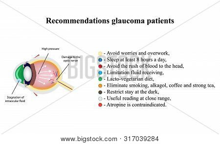 Glaucoma. Recommendations Glaucoma Patients. The Structure Of The Eye. Infographics. Illustration On