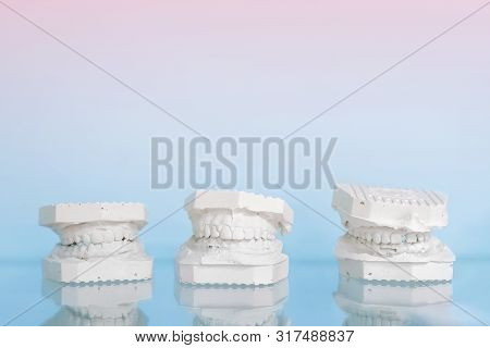 Different Gypsum Human Jews Model On Glass Shelf At Dentist Office On Light Blue Background. Dentist