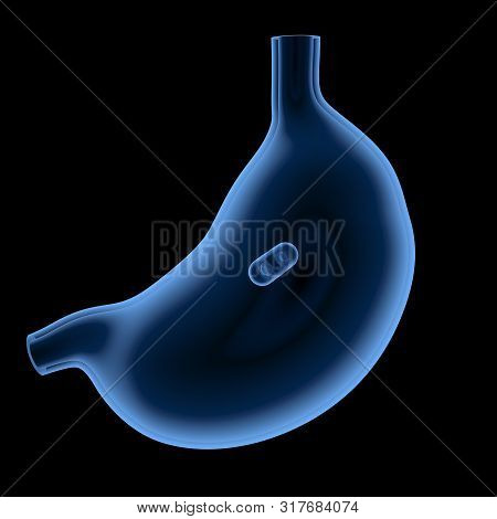3d Rendering X-ray Capsule Endoscopy In Stomach Isolated On Black