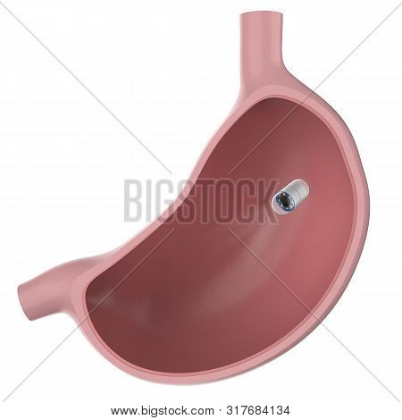 3d Rendering Capsule Endoscopy In Stomach Isolated On White