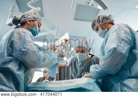 Cosmetic Liposuction Surgery In Actual Operating Room Setting Showing Surgeons Group During Operatio