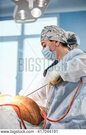 Cosmetic Liposuction Surgery In Actual Operating Room Setting Showing Surgeons Group During Operatio