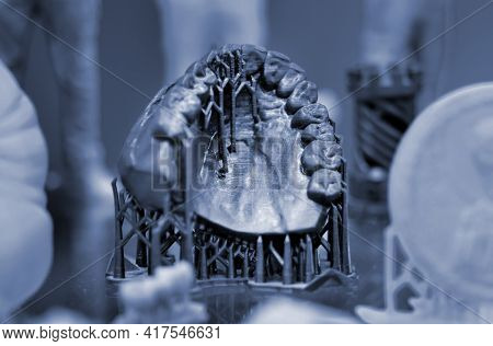 The Lower Jaw Of A Man, Created On A 3d Printer From A Photopolymer Material