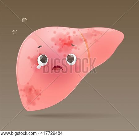 Hepatitis Illustration. Cartoon Liver Disease On A Brown Background