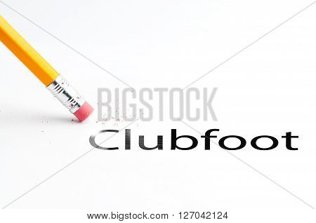 Closeup of pencil eraser and black clubfoot text. Clubfoot. Pencil with eraser.