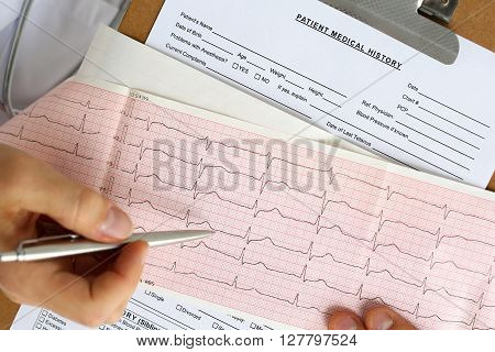 Male Medicine Doctor Hands Hold And Show To Patient Cardiogram