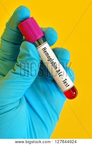 Test tube with blood sample for hemoglobin A1c (HbA1c) test, diabetes diagnosis
