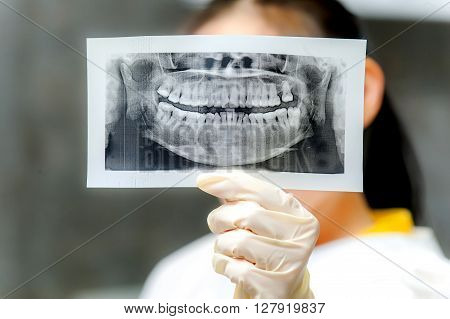 Dentist looking at x-ray picture in the office