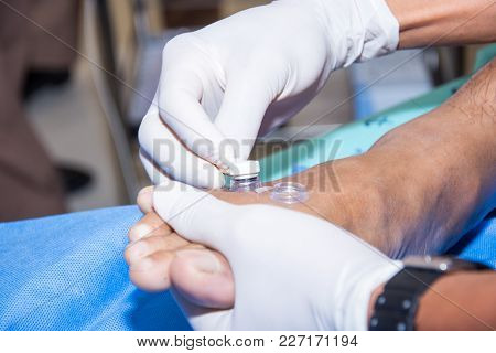 Probe Connecting For Transcutaneous Oxymetry Health Care Technology Equipment