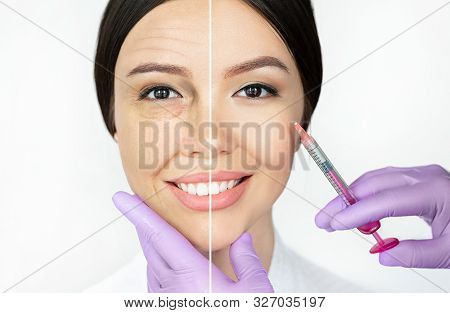 Comparison Woman's Face With Wrinkle And Smooth Young Face After Beauty Injections. Aged Facial Skin