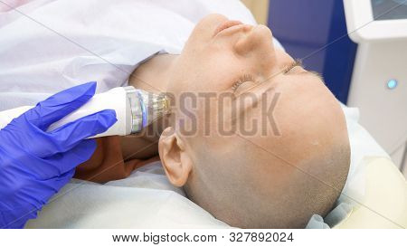 Close-up. Microneedle Rf Lifting Procedure. Hardware Cosmetology. Beautician Conducts A Facial Rejuv