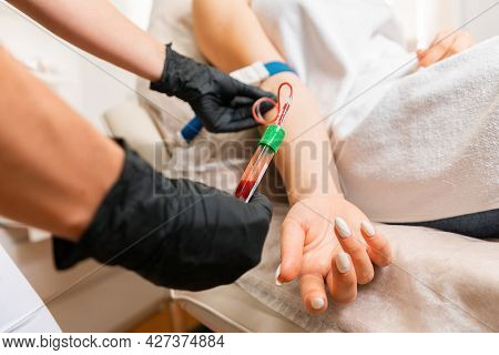 Cosmetologist Makes Blood Sampling From The Client's Hand For The Plasmolifting Procedure. Professio