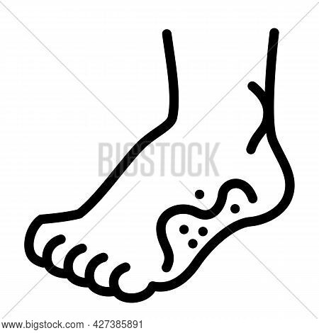 Foot Frostbite Icon. Outline Foot Frostbite Vector Icon For Web Design Isolated On White Background
