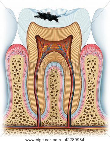 Principle of a cavity