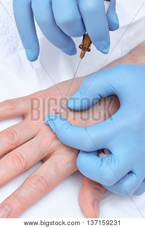 Anti-age injection therapy. Hand rejuvenation in clinic