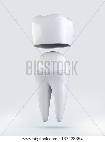 3D Illustration Of Crown Tooth On White Background.