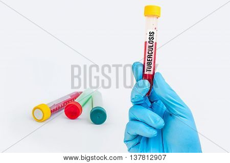 Test-tube With Blood Sample For Tuberculosis Test