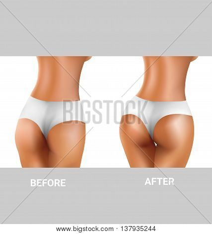 before and after sexy buttocks exercise for healthy concept