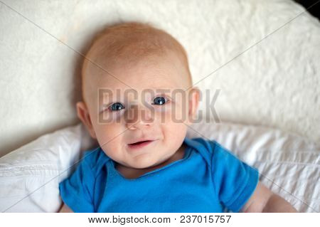 Traces Of Diathesis On The Baby Cheeks
