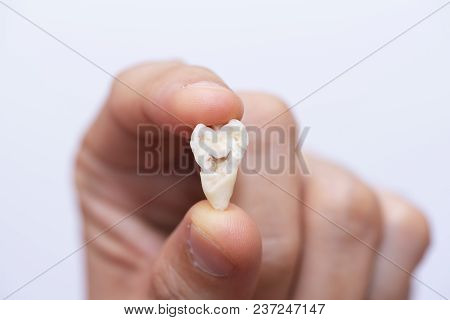 A Person Using Finger To Hold A Half Of Extracted Wisdom Tooth Stained On White Background