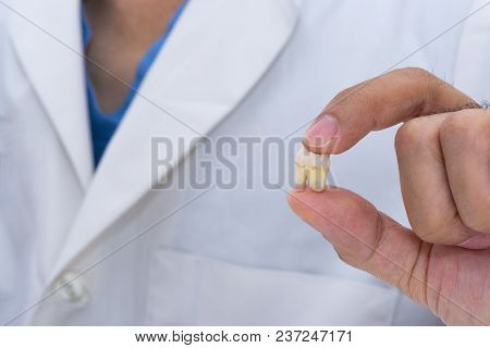 A Dentist Using Finger Hold An Extracted Wisdom Tooth On The White Background
