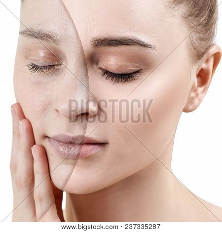 Comparison Portrait Of Young Woman With And Without Makeup. Close-up Shot.