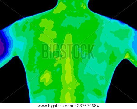 Thermographic Image Of The Upper Back Of A Woman With The Photo Showing Different Temperature In A R