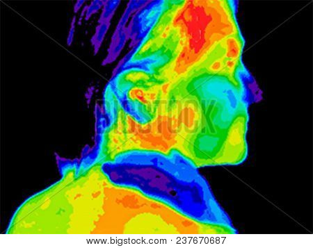 Thermographic Image Of The Right Side Of The Face Of A Woman With Her Hand On Her Neck With The Phot