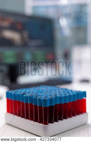 Close Up Of Vacutainers With Blood In Science Laboratory. Glass Tubes On Tray Filled With Substance 