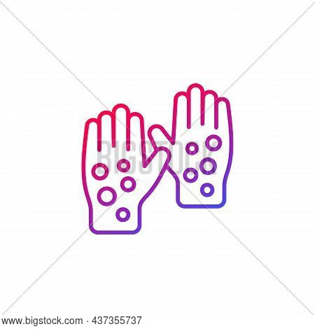 Psoriasis Or Rash Line Icon On White