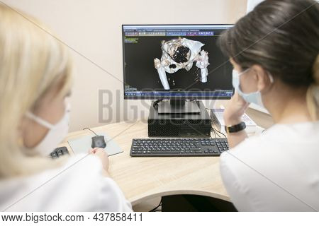 Doctors Review The Tomography Results In A Computer. Belarus, Gomel, May 30, 2021 Central Hospital.d