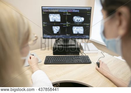 Doctors Review The Tomography Results In A Computer. Belarus, Gomel, May 30, 2021 Central Hospital.d