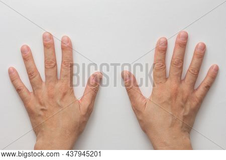 Top View Of Middle Aged Woman Hands With Cut And Uncoloured Nails On The White Background