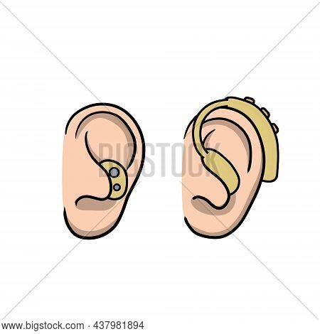 Hearing Aid. Audiphone In Ear. Hearing Problems And Disabilities. Set Of Cartoon Illustration