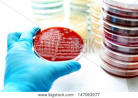 Colonies of bacteria in blood agar (culture medium plate)