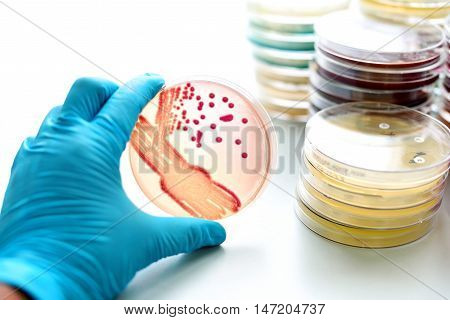 Colonies of bacteria in MacConkey agar (culture medium plate)