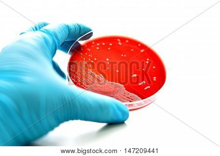 Colonies of bacteria in blood agar (culture medium plate)