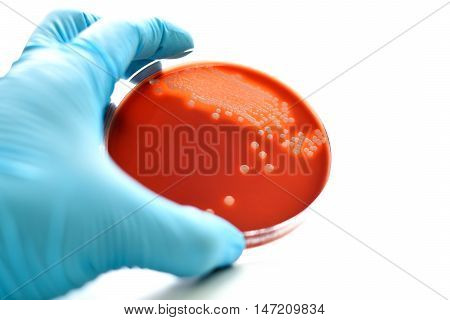 Colonies of bacteria in blood agar (culture medium plate)