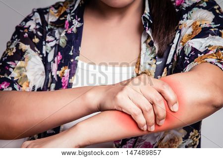 Asian woman having arm pain ,clutching the arm