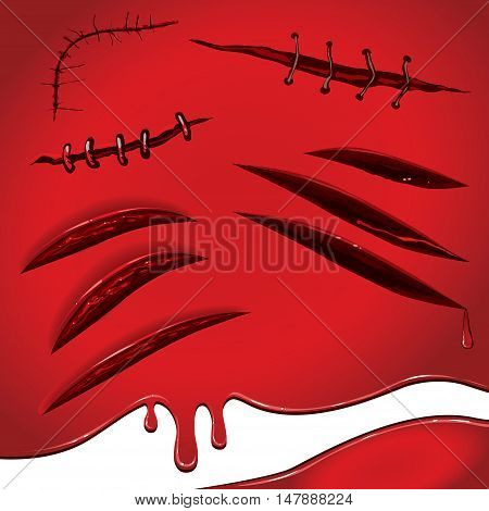 Red blood stains bruising set of wounds sewn scars and scratches all the elements separately on a red background