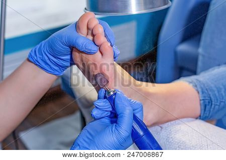 Master During A Pedicure. The Process Of Professional Pedicures. The Wizard In The Mask Causes The G