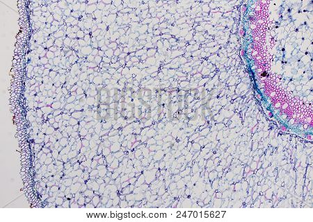 Cross Sections Of The Plant Root Under The Microscope View For Education