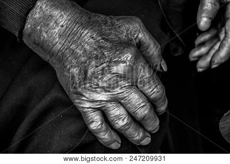 Two Hands Of An Old Woman On A Knees.wrinkles Of An Elderly Grandmother.hands Of An Old Woman With W