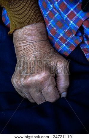 Two Hands Of An Old Woman On A Knees.wrinkles Of An Elderly Grandmother.hands Of An Old Woman With W