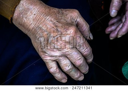 Two Hands Of An Old Woman On A Knees.wrinkles Of An Elderly Grandmother.hands Of An Old Woman With W
