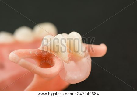 Large Image Of A Modern Denture On A Black Background