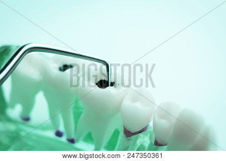 Dentist Cleaning Teeth