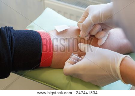 Close Up Of Doctor Hands Taking Blood From Male Vein Into Tube By Catheter